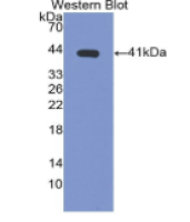 纤维蛋白原相关蛋白1(FGL1)单克隆抗体