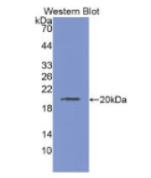 层粘连蛋白γ3(LAMC3)单克隆抗体