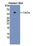 白介素6(IL6)单克隆抗体