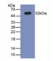 膜铁转运蛋白(FPN)单克隆抗体