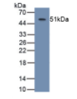 天冬氨酸β羟化酶(ASPH)单克隆抗体