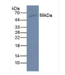 吻素1(KISS1)单克隆抗体