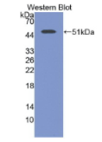 神经元特异性烯醇化酶(NSE)单克隆抗体