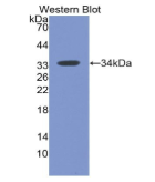 黏病毒耐药蛋白1(MX1)单克隆抗体