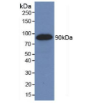 血管内皮生长因子受体2(VEGFR2)单克隆抗体