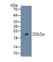 淋巴毒素β受体(LTbR)单克隆抗体
