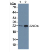 氨基端前脑钠素(NT-ProBNP)单克隆抗体