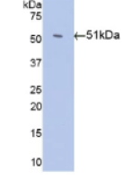 抗凝血酶(AT)单克隆抗体