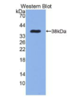 表皮生长因子(EGF)单克隆抗体