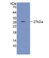 C反应蛋白(CRP)单克隆抗体