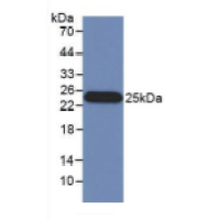 干扰素β(IFNb)单克隆抗体