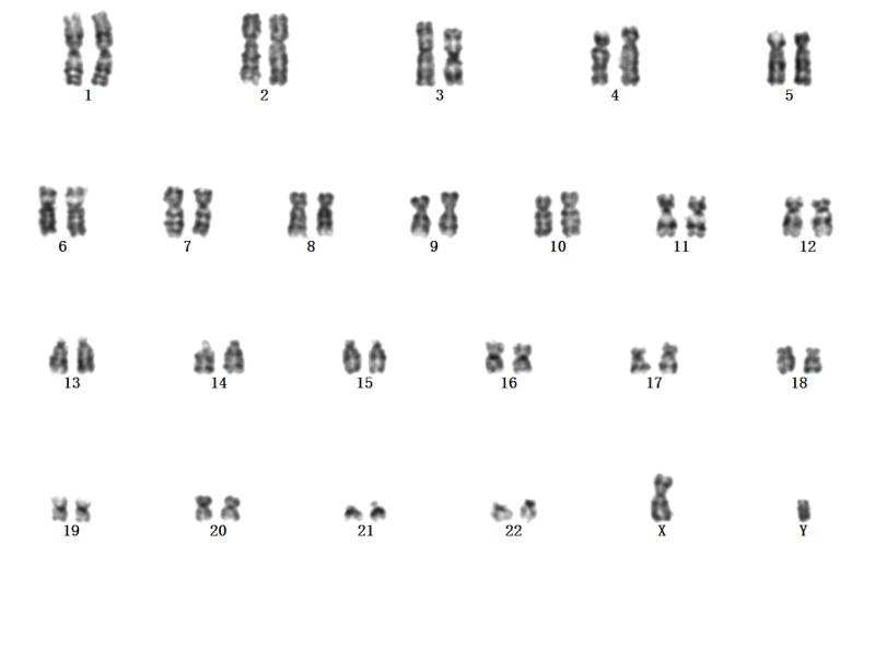 细胞染色体核型分析服务