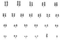 细胞染色体核型分析服务