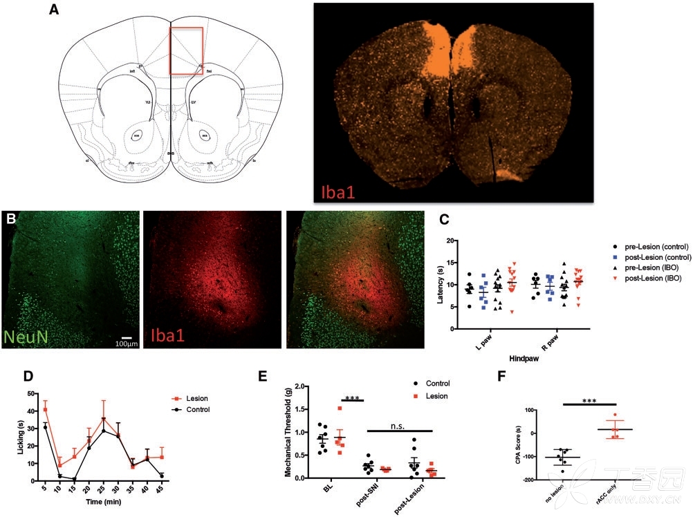 cortex underlies the affective (aversive), but not the sensory