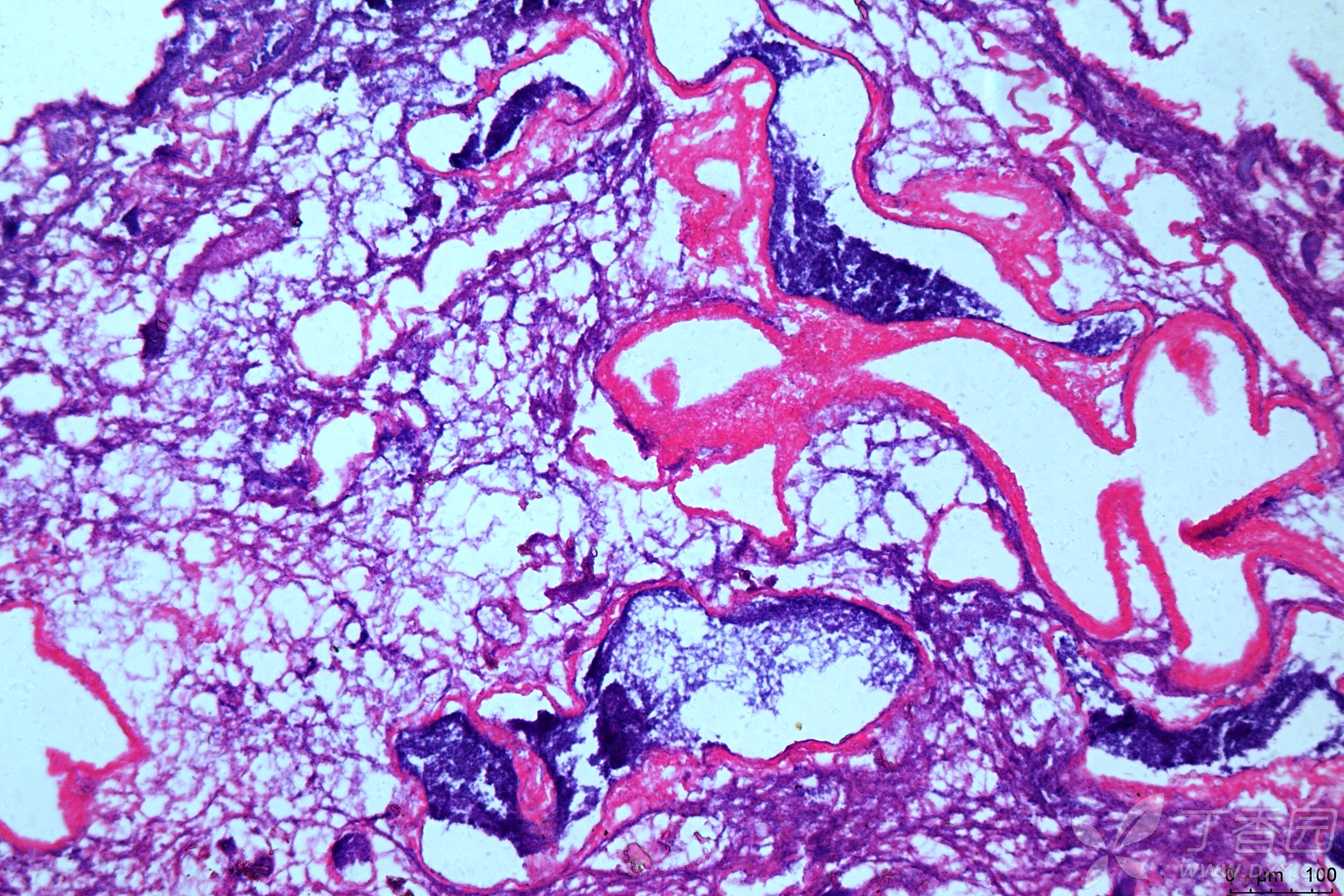 请问he染色后,肝组织中的大团的紫色是什么,是聚集在一起的细胞团吗?
