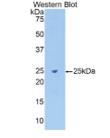 纤连蛋白(FN)多克隆抗体(生物素标记)