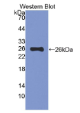 粘蛋白5B(MUC5B)多克隆抗体