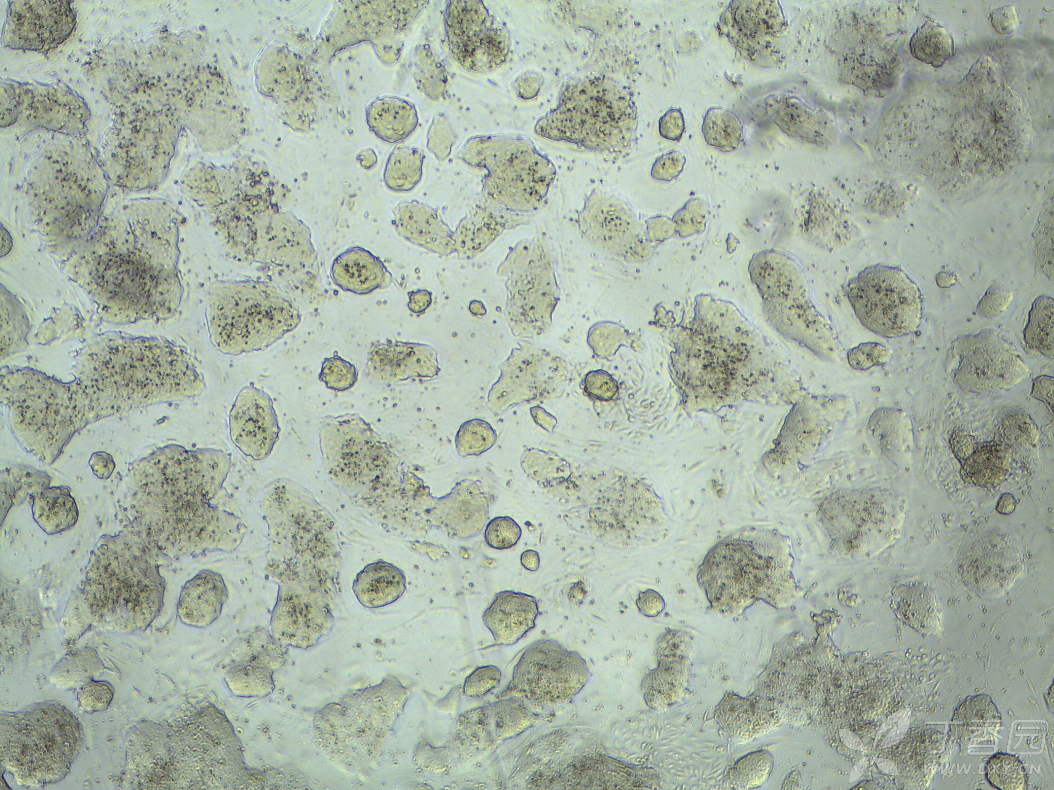 小鼠胚胎干细胞,克隆里很多小黑点,不是漂浮的,想问一下各位战友,这是