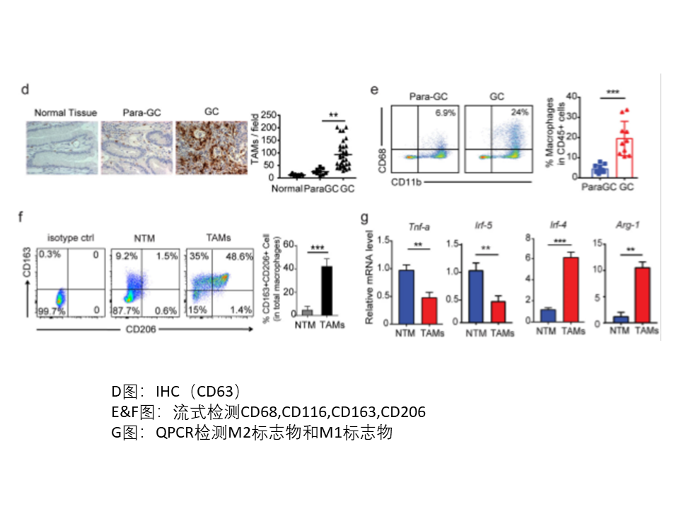 肿瘤相关巨噬细胞来源的外泌体通过传递APOE促进胃癌细胞的迁移