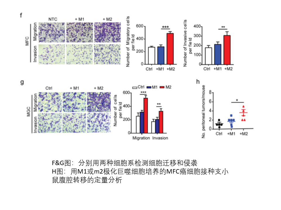肿瘤相关巨噬细胞来源的外泌体通过传递APOE促进胃癌细胞的迁移
