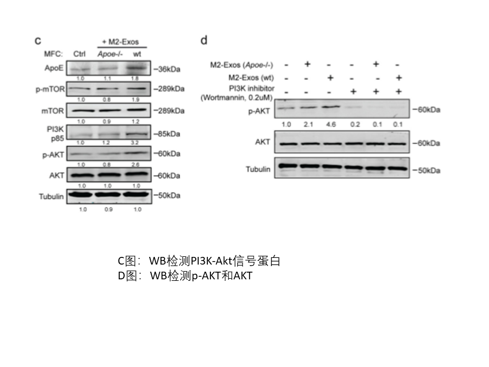 肿瘤相关巨噬细胞来源的外泌体通过传递APOE促进胃癌细胞的迁移