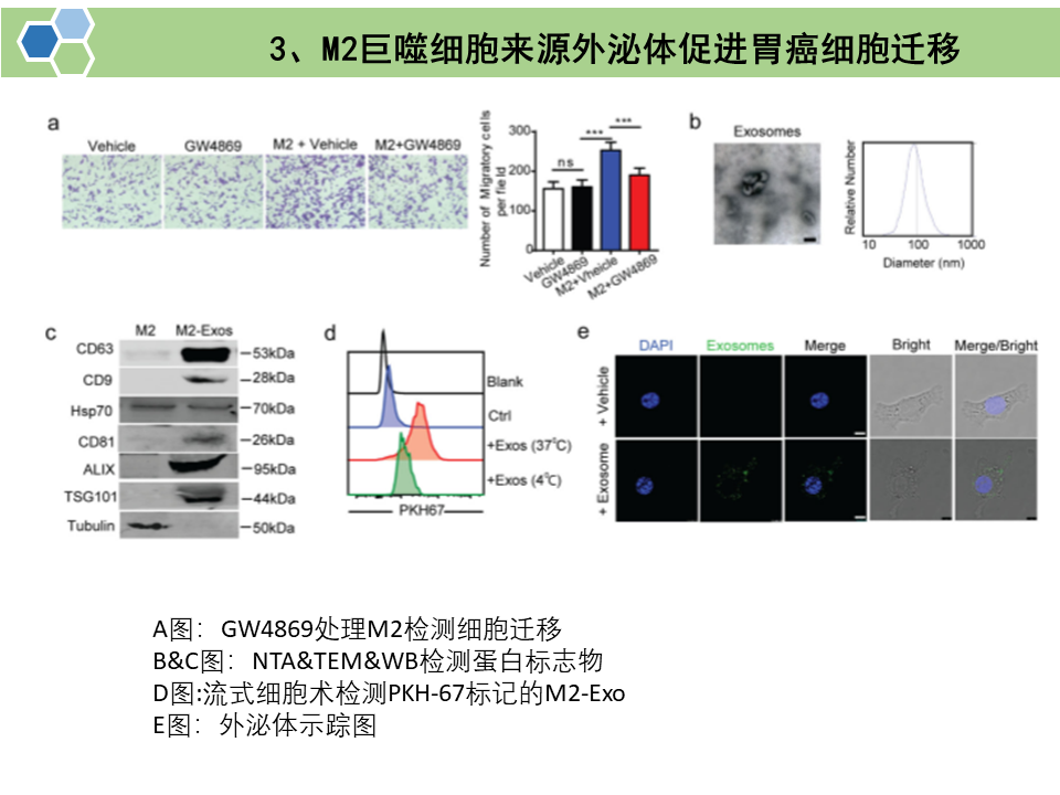 肿瘤相关巨噬细胞来源的外泌体通过传递APOE促进胃癌细胞的迁移