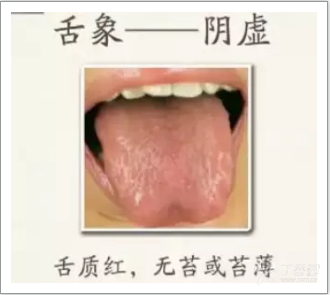 怎么拥有一个健康的舌头 3358383184617591875-8w.png