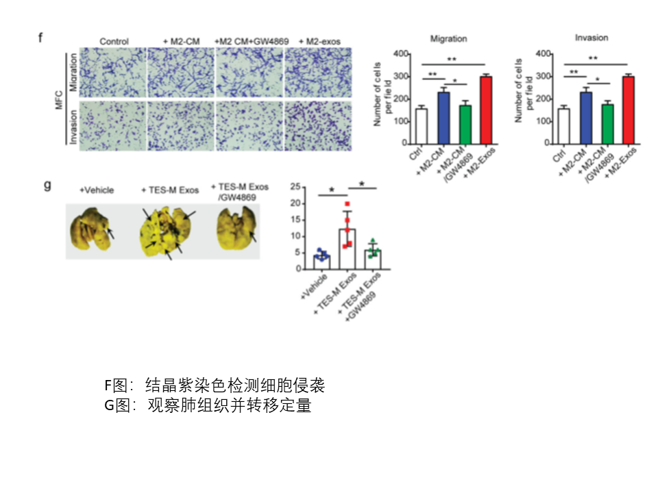 肿瘤相关巨噬细胞来源的外泌体通过传递APOE促进胃癌细胞的迁移