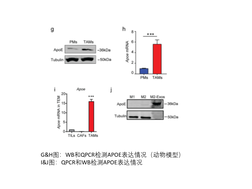 肿瘤相关巨噬细胞来源的外泌体通过传递APOE促进胃癌细胞的迁移