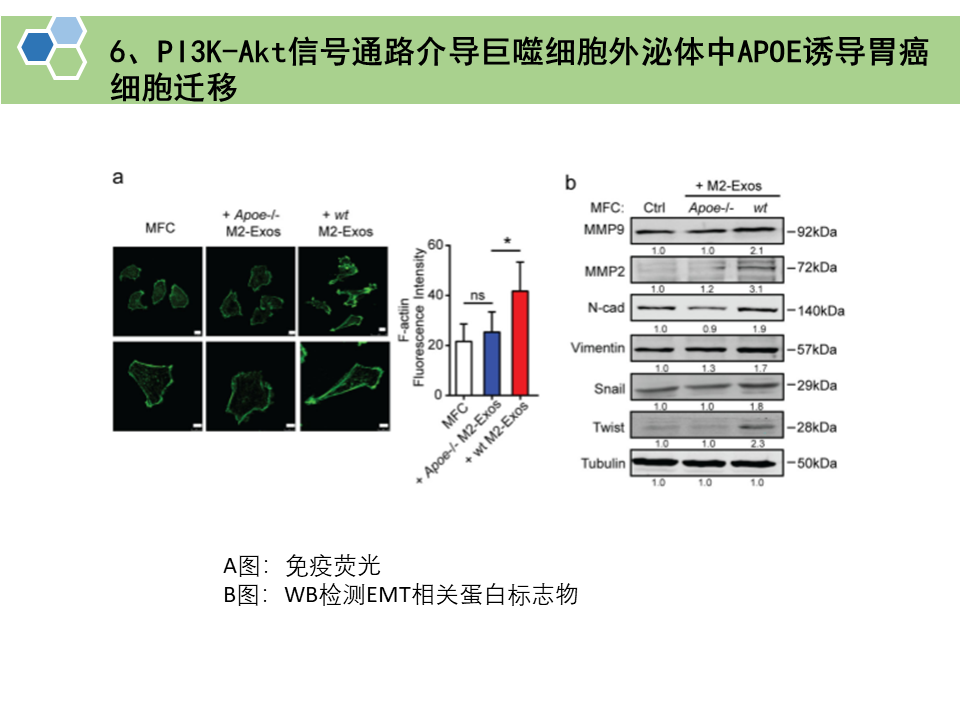 肿瘤相关巨噬细胞来源的外泌体通过传递APOE促进胃癌细胞的迁移