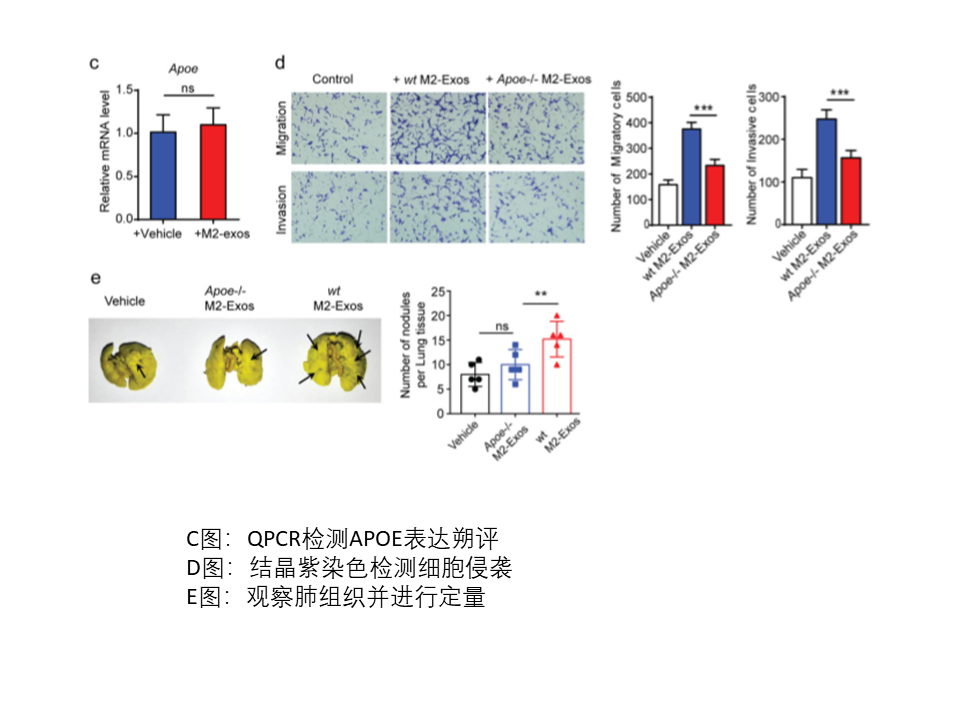 肿瘤相关巨噬细胞来源的外泌体通过传递APOE促进胃癌细胞的迁移