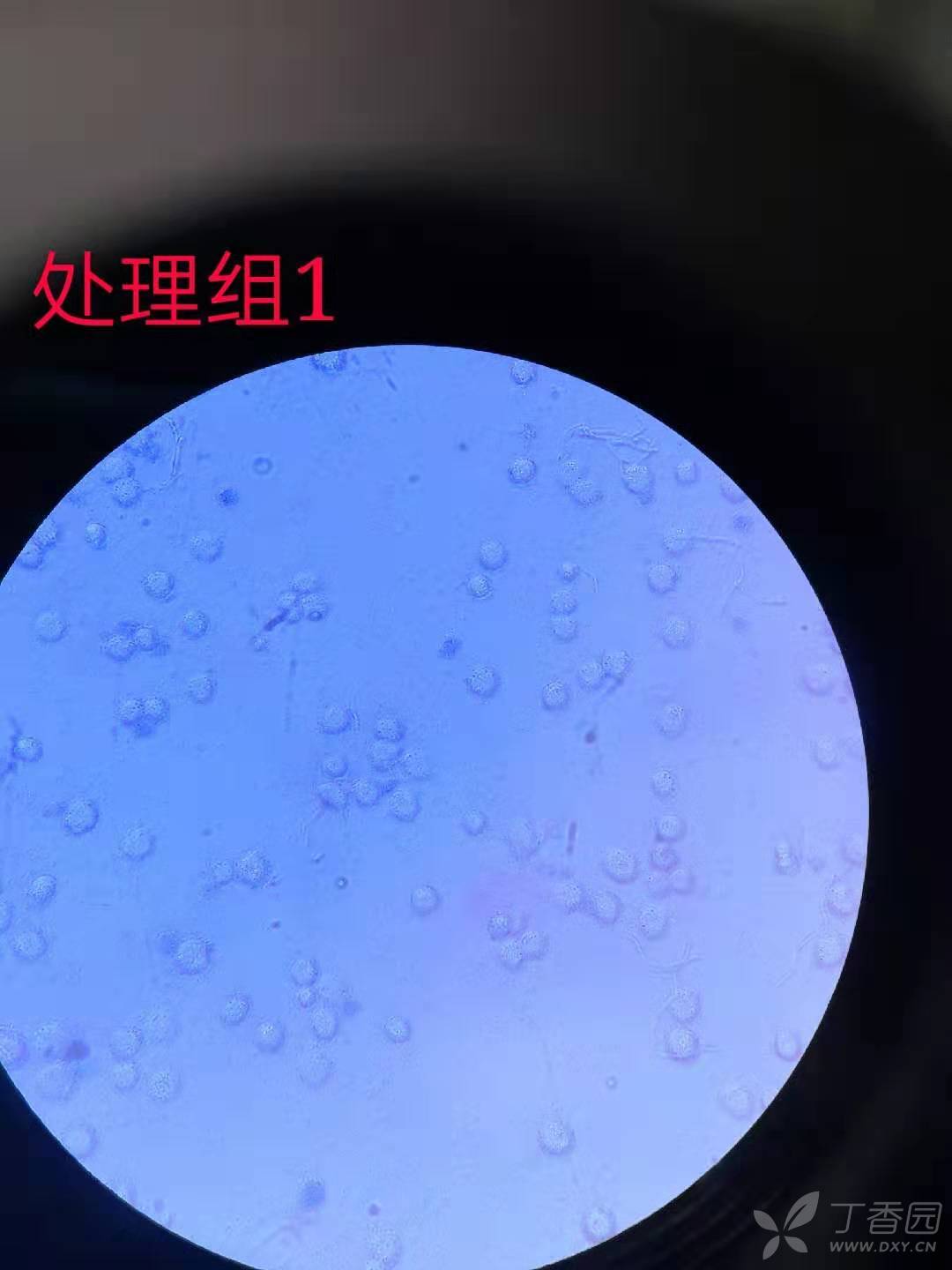 细胞处理后细胞膜明显破裂,但是却并不能被台盼蓝染色,请大家帮忙看看