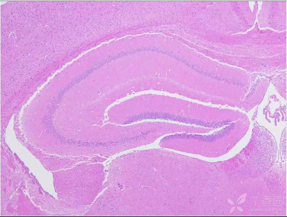 求问大神们:小鼠海马he切片出现裂纹是怎么回事?