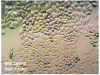 子宫内膜癌细胞株