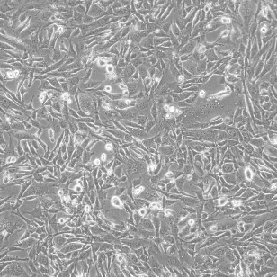 小鼠胚胎成纤维细胞3T3-L1