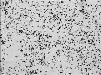 睾丸酮丛毛单胞菌