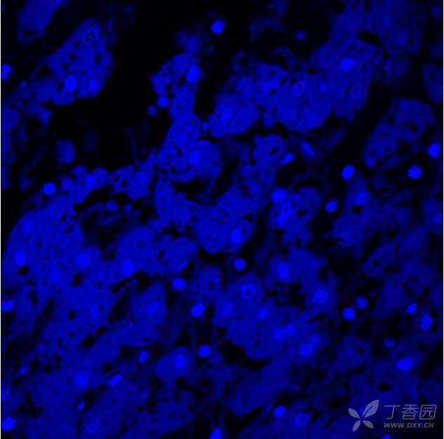 DAPI 染核染不上是怎么回事？一批做的正常肝细胞，结果不同。