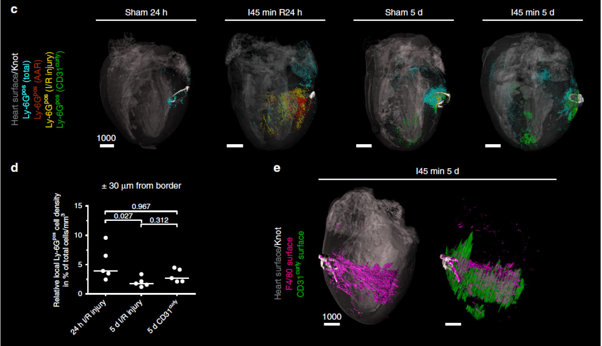 器官三维成像时代已到来！你不可不知的组织透明与光片扫描技术