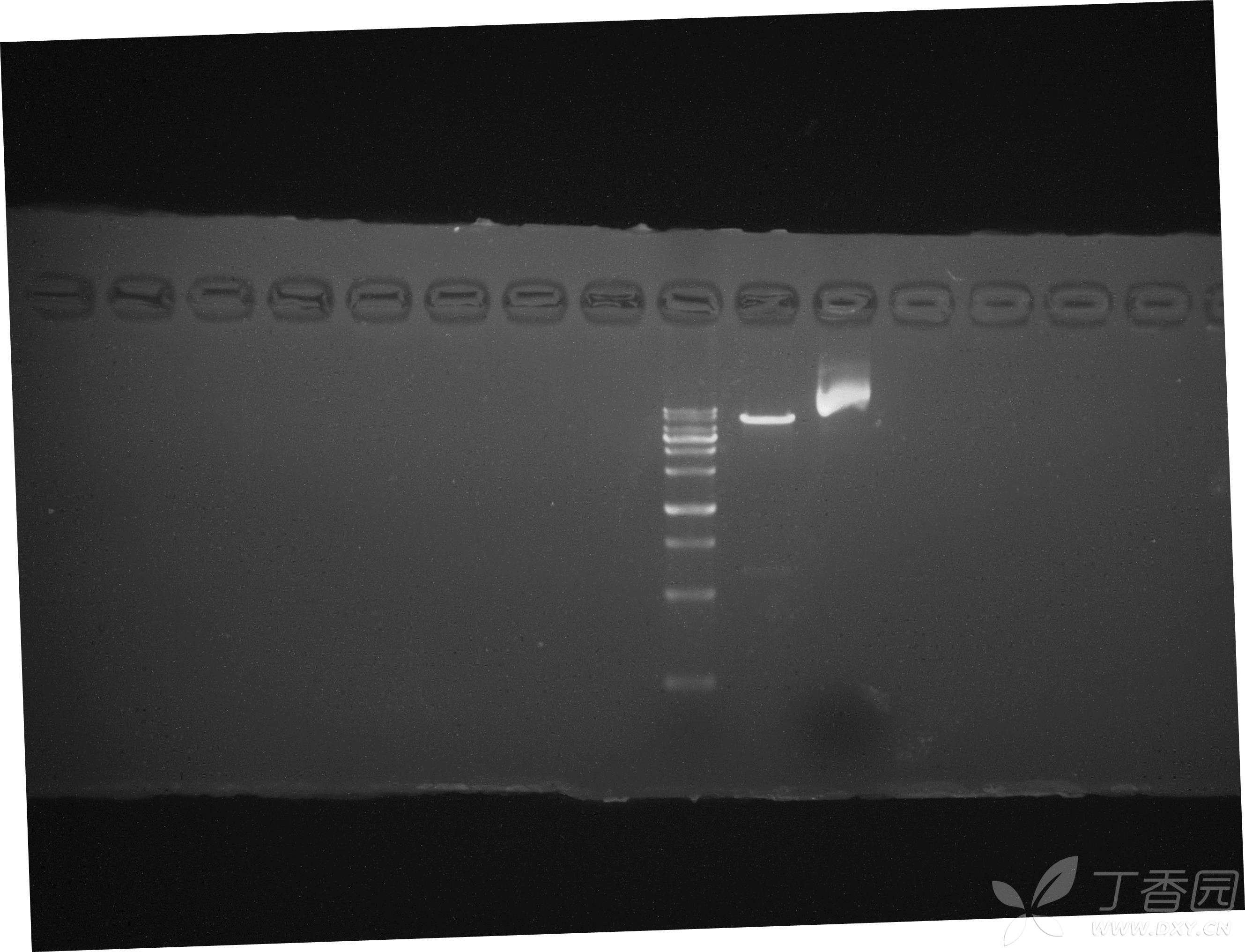 导致质粒超螺旋条带电泳偏大有哪些因素