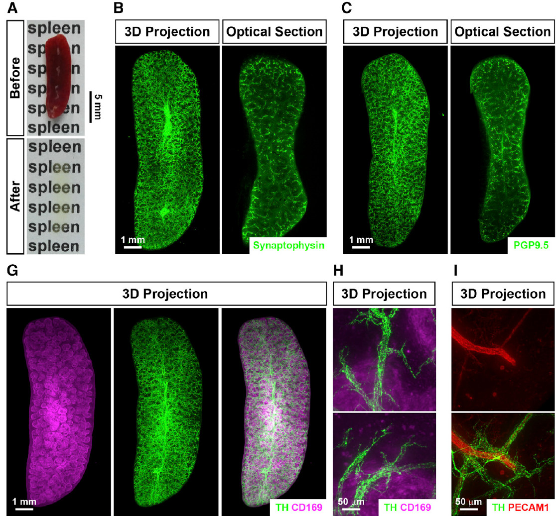 器官三维成像时代已到来！你不可不知的组织透明与光片扫描技术