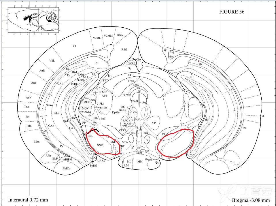 请大家帮忙看一下我的小鼠脑组织he染色是否是黑质区