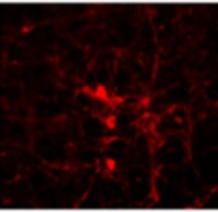 光遗传/光激活/高频 AAV病毒 rAAV-hSyn-hChR2(E123T/T159C