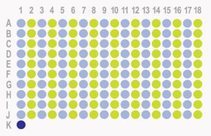 生存期胰腺癌180点组织芯片HPan-Ade180Sur-01