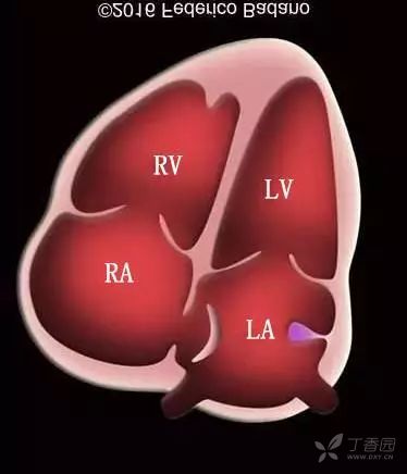 华法林嵴(coumadin ridge) [病例帖]