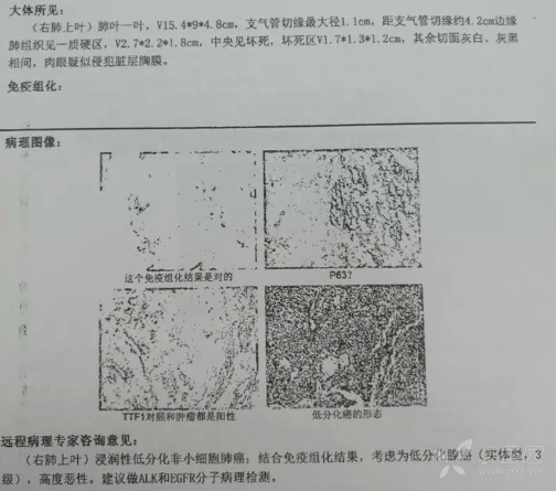 平度50岁以上的有多少人口_50岁女人