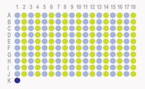生存期肾透明细胞癌 180点组织芯片HKid-CRC180Sur-01