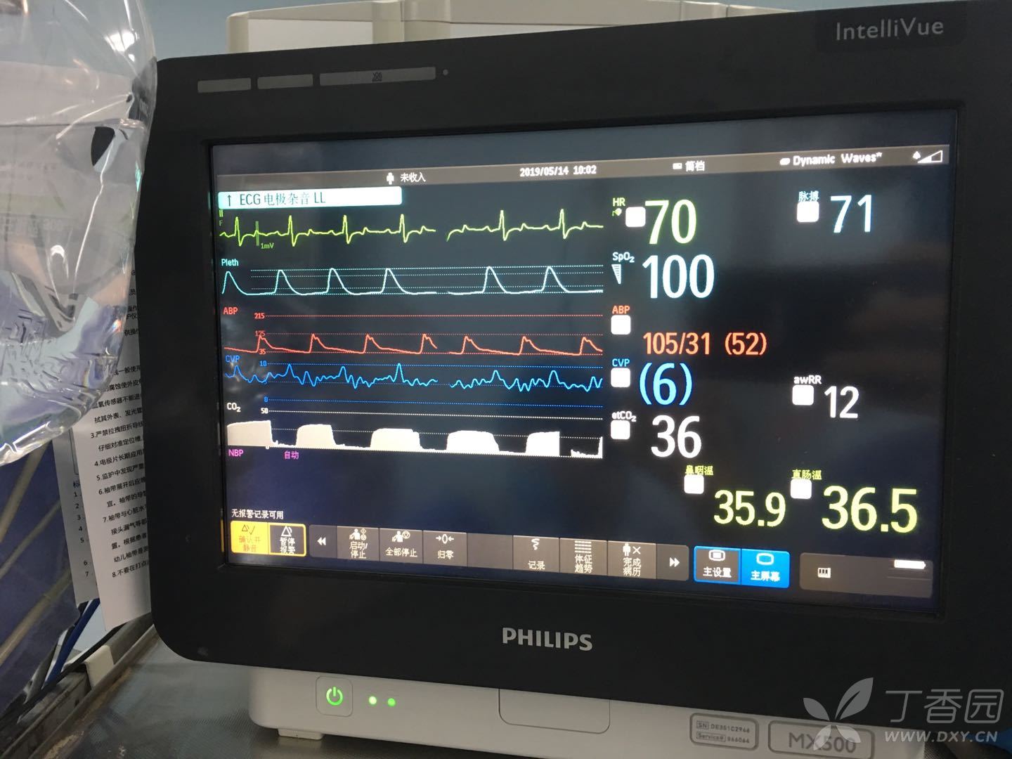 菜鸟求助,phillip监护仪测得的中心静脉压单位是什么?