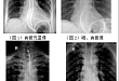 浅谈动态 DR 在基层医疗机构临床诊断中的主体作用