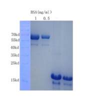 IBSP| Human Bone sialoprotein 2蛋白