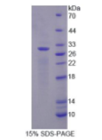 肌红蛋白(MYO)天然蛋白